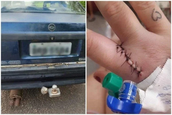 Homem amarra ex em carro com mangueira e arrasta mulher por 50 m em SP mundo