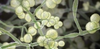 Cientistas descrevem maior surto do fungo Candida auris no Brasil