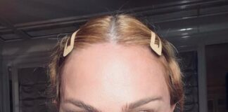 Madonna é internada e segue tratamento em seu apartamento