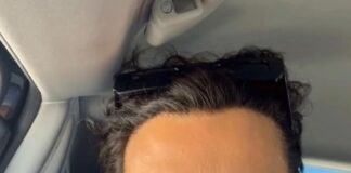 Wagner Santiago, ex-BBB, compartilha experiência de procedimento para aumento peniano