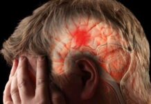 A cada 6,5 minutos, um brasileiro morre por AVC: número de internações e custos dobram em cinco anos