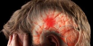 Previsão alarmante: Mortes por AVC devem aumentar 50% até 2050, alerta OMS