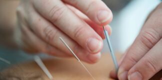 Alternativas à acupuntura com agulhas: técnicas eficazes e sem dor