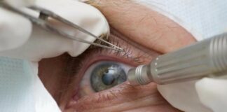 Falha em esterilização causa infecção em 15 pacientes após mutirão de catarata