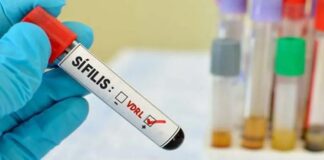 Queda geral nos casos de HIV, mas aumento preocupante entre jovens