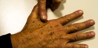 Dia mundial do câncer: especialistas reforçam prevenção e tratamento adequado