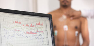 Confira as unidades Sesc-DF que realizam exames cardiológicos e oftalmológicos