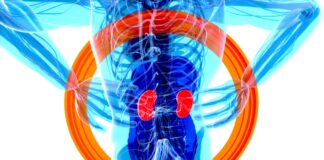 Campanha da SBU alerta para o câncer de rim