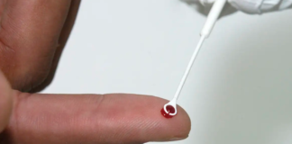 Vacina contra HPV pode beneficiar também mulheres adultas