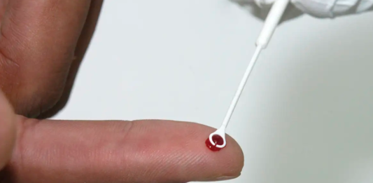 Fiji declara emergência nacional após aumento de casos de HIV