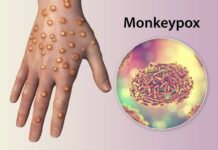 Mpox: o que é mito e o que é verdade sobre a doença que voltou ao centro do debate global