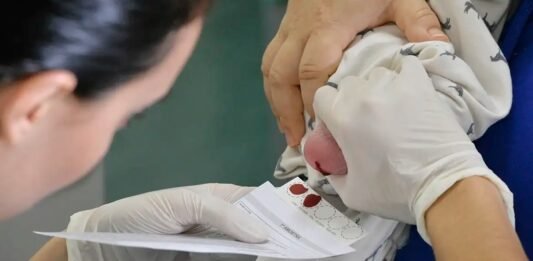 Doença falciforme exige diagnóstico precoce