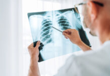 Estudo brasileiro aponta obesidade e inflamação como fatores de envelhecimento