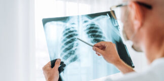 Estudo brasileiro aponta obesidade e inflamação como fatores de envelhecimento