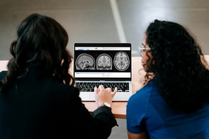 Estudo do New England Journal of Medicine aponta que muitos aneurismas cerebrais não rompidos podem ser acompanhados sem cirurgia saude cerebro cabeca tc imagem