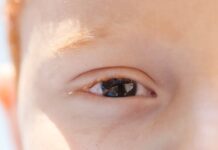 Atendimento oftalmológico de crianças com autismo exige adaptação e preparo