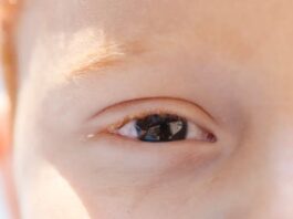 Atendimento oftalmológico de crianças com autismo exige adaptação e preparo