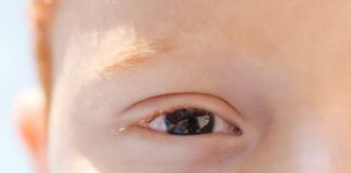 Atendimento oftalmológico de crianças com autismo exige adaptação e preparo