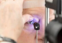 Ministério da Saúde busca parceria para padronizar cirurgias contra tracoma no Brasil