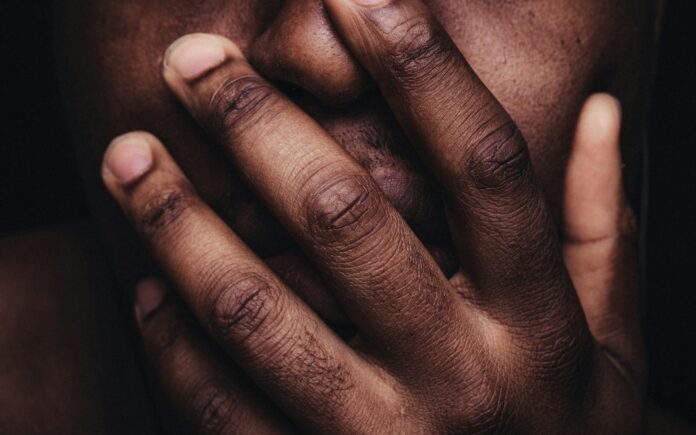 Dermatologia avança na inclusão: cuidados com a pele negra ganham espaço na medicina e na indústria brasilia