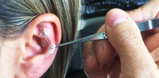 Senac-DF ensina Auriculoterapia