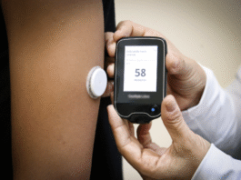 SES-DF abre licitação de R$ 7,2 milhões para compra de sensores de monitoramento contínuo de glicose