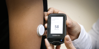 SES-DF abre licitação de R$ 7,2 milhões para compra de sensores de monitoramento contínuo de glicose