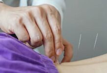 Lei regulamenta a profissão de acupunturista no Brasil