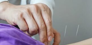 Lei regulamenta a profissão de acupunturista no Brasil