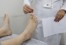 Pesquisa internacional avalia ferramenta para rastrear neuropatia periférica diabética