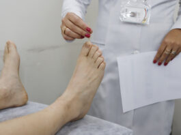 Pesquisa internacional avalia ferramenta para rastrear neuropatia periférica diabética