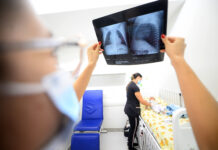 Aumento de casos de síndrome gripal exige atenção redobrada com crianças e idosos