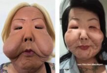 Juju do Pix celebra avanços após seis meses de reconstrução facial