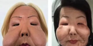 Juju do Pix celebra avanços após seis meses de reconstrução facial