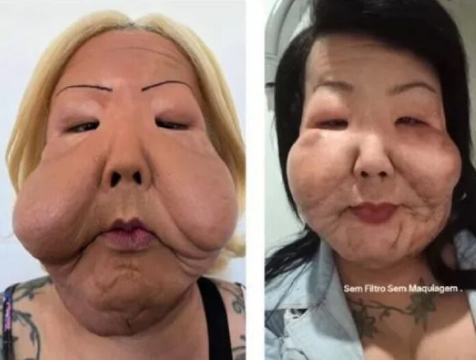 Juju do Pix celebra avanços após seis meses de reconstrução facial cultura juju do pix