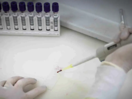 São Paulo investiga novo caso suspeito de ebola