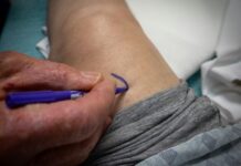 Cirurgia robótica aumenta precisão na prótese de joelho, mas benefício ao paciente é questão central