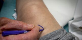 Cirurgia robótica aumenta precisão na prótese de joelho, mas benefício ao paciente é questão central